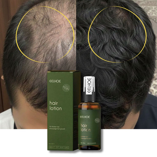 زيت ™HairLotion — السر المخفي لنمو شعر أقوى وأكثـف!